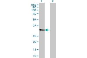 Western Blot analysis of CDV3 expression in transfected 293T cell line by CDV3 MaxPab polyclonal antibody. (CDV3 抗体  (AA 1-213))