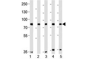Western Blotting (WB) image for anti-Insulin Receptor-Related Receptor (INSRR) (AA 668-702) antibody (ABIN3029735)
