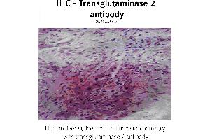 Image no. 2 for anti-Transglutaminase 2 (C Polypeptide, Protein-Glutamine-gamma-Glutamyltransferase) (TGM2) antibody (ABIN346957) (Transglutaminase 2 抗体)