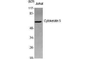 Western Blot analysis of various cells using Cytokeratin 5 Polyclonal Antibody diluted at 1:1000.