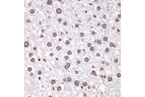 Immunohistochemistry of paraffin-embedded mouse liver using TOP1 antibody. (Topoisomerase I 抗体  (AA 1-100))