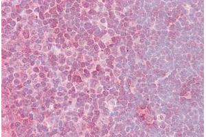 Anti-CRKL antibody IHC staining of human thymus. (CrkL 抗体  (AA 292-303))