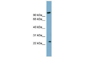 ARL8B antibody used at 1 ug/ml to detect target protein. (ARL8B 抗体  (Middle Region))