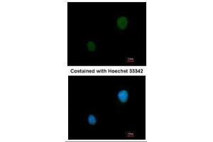 ICC/IF Image Immunofluorescence analysis of methanol-fixed HeLa, using PKA 2 beta, antibody at 1:200 dilution. (PKA 2 beta (Center) 抗体)