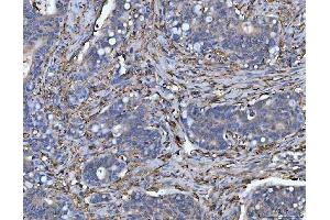 IHC analysis of HLA-DRA using anti-HLA-DRA antibody (ABIN7600948). (HLA-DRA 抗体  (AA 26-254))