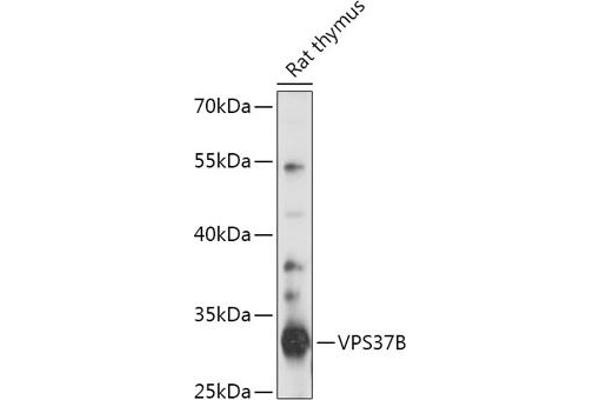 VPS37B 抗体  (AA 60-170)