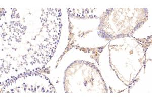 Immunohistochemistry (IHC) image for anti-Apolipoprotein E (APOE) (AA 19-168) antibody (ABIN7429139)