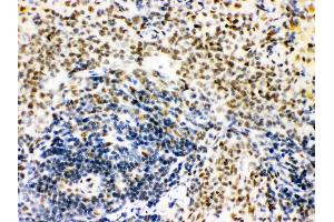 Anti- CTBP1 Picoband antibody, IHC(P) IHC(P): Rat Spleen Tissue (CTBP1 抗体  (C-Term))
