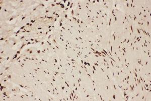 Immunohistochemistry (IHC) image for anti-Arachidonate 5-Lipoxygenase (ALOX5) (AA 120-483) antibody (ABIN3043727)