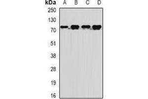 Western blot analysis of MTMR14 expression in BT474 (A), Jurkat (B), mouse liver (C), rat brain (D) whole cell lysates. (MTMR14 抗体)