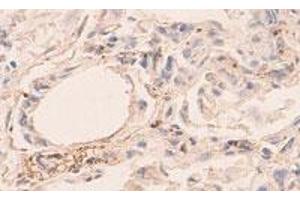 Immunohistochemical staining of formalin-fixed paraffin-embedded human lung showing staining with ANGPT4 polyclonal antibody  at 1:100 dilution. (Angiopoietin 4 抗体)