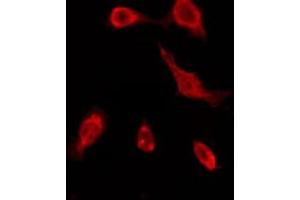 ABIN6276162 staining COLO205 by IF/ICC. (OR51A7 抗体  (C-Term))
