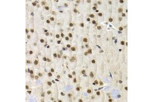 Immunohistochemistry of paraffin-embedded mouse brain using UMPS antibody (ABIN5973202) at dilution of 1/200 (40x lens). (UMPS 抗体)
