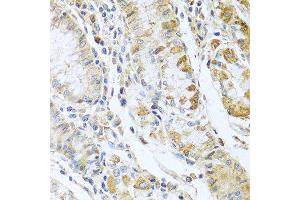 Immunohistochemistry of paraffin-embedded human stomach using RNASE13 antibody at dilution of 1:100 (40x lens). (RNASE13 抗体)