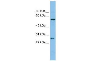 Chymotrypsinogen B1 antibody used at 1 ug/ml to detect target protein. (CTRB1 抗体  (Middle Region))
