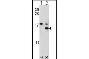 Western blot analysis of S100A11 (arrow) using rabbit polyclonal S100A11 Antibody (S6) (ABIN389308 and ABIN2839429). (S100A11 抗体  (AA 1-30))