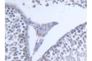 Detection of PLTP in Rat Testis Tissue using Polyclonal Antibody to Phospholipid Transfer Protein (PLTP) (PLTP 抗体  (AA 337-479))