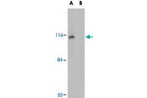 Western blot analysis of JPH3 in Daudi cell lysate with JPH3 polyclonal antibody  at 1 ug/mL in (A) the absence and (B) the presence of blocking peptide. (Junctophilin 3 抗体  (Internal Region))