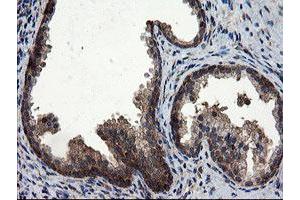 Image no. 9 for anti-CCR4-NOT Transcription Complex Subunit 4 (CNOT4) (AA 190-455) antibody (ABIN1491098)