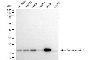 Western blotting analysis using Peroxiredoxin 5 antibody (ABIN7799780).