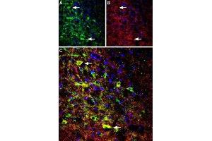 Expression of NTSR1 in rat brainImmunohistochemical staining of perfusion-fixed frozen rat brain sections using Anti-Neurotensin Receptor 1 (extracellular) Antibody (ABIN7043383, ABIN7044767 and ABIN7044768), (1:100). (Neurotensin Receptor 1 (High Affinity) (NTSR1) Peptide)