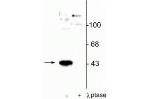 Western blot of human T47D cells showing specific immunolabeling of the ~45 kDa MEK 1 protein phosphorylated at Thr386 in the first lane (-). (MEK1 抗体  (pThr386))