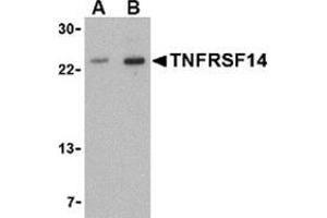 Western blot analysis of TNFRSF14 in mouse thymus tissue lysate with this product at (A) 1 and (B) 2 μg/ml.
