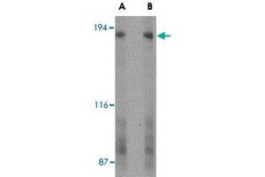 Western blot analysis of GPR124 in human bladder tissue lysate with GPR124 polyclonal antibody  at (A) 2 and (B) 4 ug/mL .