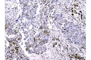 IHC analysis of Cytochrome C using anti-Cytochrome C antibody (ABIN5693008).