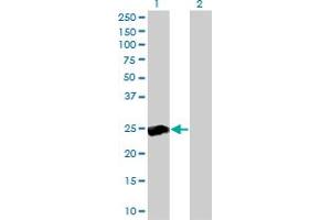 Western Blot analysis of RALB expression in transfected 293T cell line by RALB monoclonal antibody (M04), clone 4D1. (RALB 抗体  (AA 89-183))