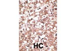 Immunohistochemistry (Paraffin-embedded Sections) (IHC (p)) image for anti-ATP-Binding Cassette, Sub-Family B (MDR/TAP), Member 11 (ABCB11) (AA 1038-1067), (C-Term) antibody (ABIN390059)