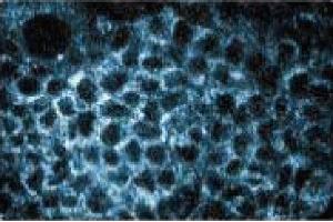 Immunofluorescence staining of A431 cells (Human epithelial carcinoma, ATCC CRL-1555). (PEX1 抗体  (AA 1049-1256))