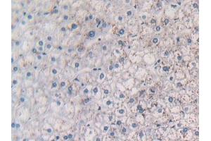 Detection of MCP1 in Human Liver Tissue using Polyclonal Antibody to Monocyte Chemotactic Protein 1 (MCP1) (CCL2 抗体  (AA 24-99))