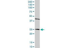 HSD17B2 MaxPab rabbit polyclonal antibody. (HSD17B2 抗体  (AA 1-387))
