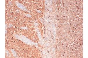Immunohistochemistry (IHC) image for anti-Calcium Channel, Voltage-Dependent, T Type, alpha 1H Subunit (CACNA1H) (AA 1019-1293) antibody (Atto 594) (ABIN2482852)