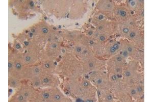 Detection of mTOR in Human Liver Tissue using Polyclonal Antibody to Serine/threonine-protein kinase mTOR (mTOR)