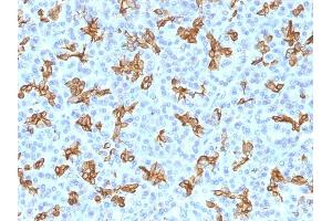 Immunohistochemistry (IHC) image for anti-Keratin 19 (KRT19) antibody (ABIN6939947)