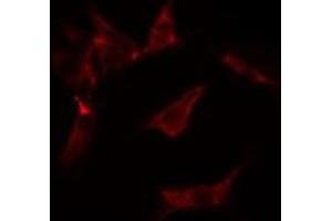 ABIN6275591 staining  Hela cells by IF/ICC.