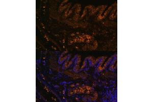 Immunofluorescence (IF) image for anti-Matrix Metallopeptidase 9 (Gelatinase B, 92kDa Gelatinase, 92kDa Type IV Collagenase) (MMP9) (AA 538-707) antibody (ABIN3022900)