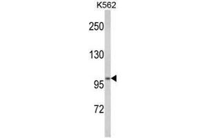 Western blot analysis of ATP12A Antibody (Center) in K562 cell line lysates (35ug/lane). (ATP12A 抗体  (Middle Region))