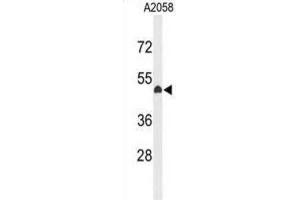 Western Blotting (WB) image for anti-Eyes Absent Homolog 4 (EYA4) antibody (ABIN3004136) (EYA4 抗体)