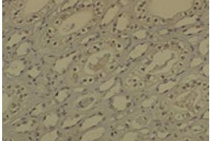 Immunohistochemistry analysis using Mouse Anti-DNMT1 Monoclonal Antibody, Clone 60B1220. (DNMT1 抗体  (AA 637-650))
