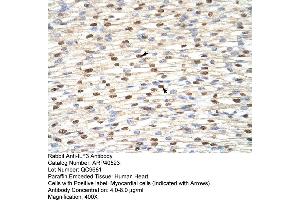 Rabbit Anti-ILF3 Antibody  Paraffin Embedded Tissue: Human Heart Cellular Data: Myocardial cells Antibody Concentration: 4. (Interleukin enhancer-binding factor 3 (ILF3) (N-Term) 抗体)