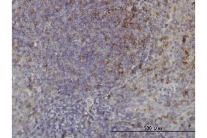 Immunoperoxidase of monoclonal antibody to USP33 on formalin-fixed paraffin-embedded human tonsil. (USP33 抗体  (AA 327-426))