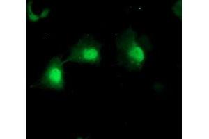 Anti-MPI mouse monoclonal antibody (ABIN2455793) immunofluorescent staining of COS7 cells transiently transfected by pCMV6-ENTRY MPI (RC208134). (MPI 抗体)