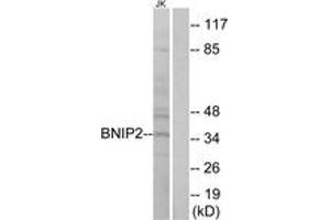 Western Blotting (WB) image for anti-BCL2/adenovirus E1B 19kDa Interacting Protein 2 (BNIP2) (AA 265-314) antibody (ABIN2890156) (BNIP2 抗体  (AA 265-314))