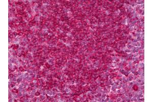 Anti-GPR35 antibody IHC of human tonsil. (GPR35 抗体)