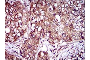 Immunohistochemistry (IHC) image for anti-Interleukin 3 Receptor, alpha (IL3RA) (AA 200-305) antibody (ABIN1845738) (IL3RA 抗体  (AA 200-305))