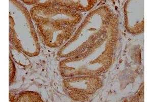 IHC image of ABIN7127838 diluted at 1:100 and staining in paraffin-embedded human prostate tissue performed on a Leica BondTM system. (Recombinant TPT1 抗体)
