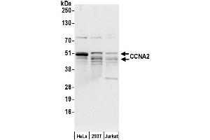 Western Blotting (WB) image for anti-Cyclin A2 (CCNA2) (AA 100-150) antibody (ABIN7450082)
